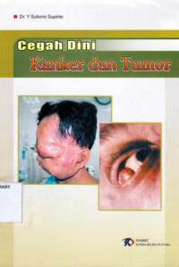 Image of Cegah Dini Kanker dan Tumor